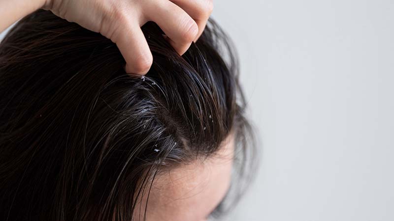 Is Rosemary Water Good for Your Hair